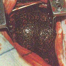 Raucherlunge2.jpg