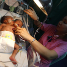 Baby mit zwei Köpfen auf den Philippinen geboren