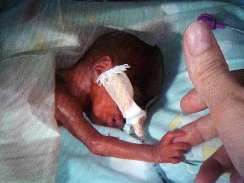 Bilgun_Neonatologie_LKHF.JPG