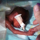 Bilgun_Neonatologie_LKHF.JPG