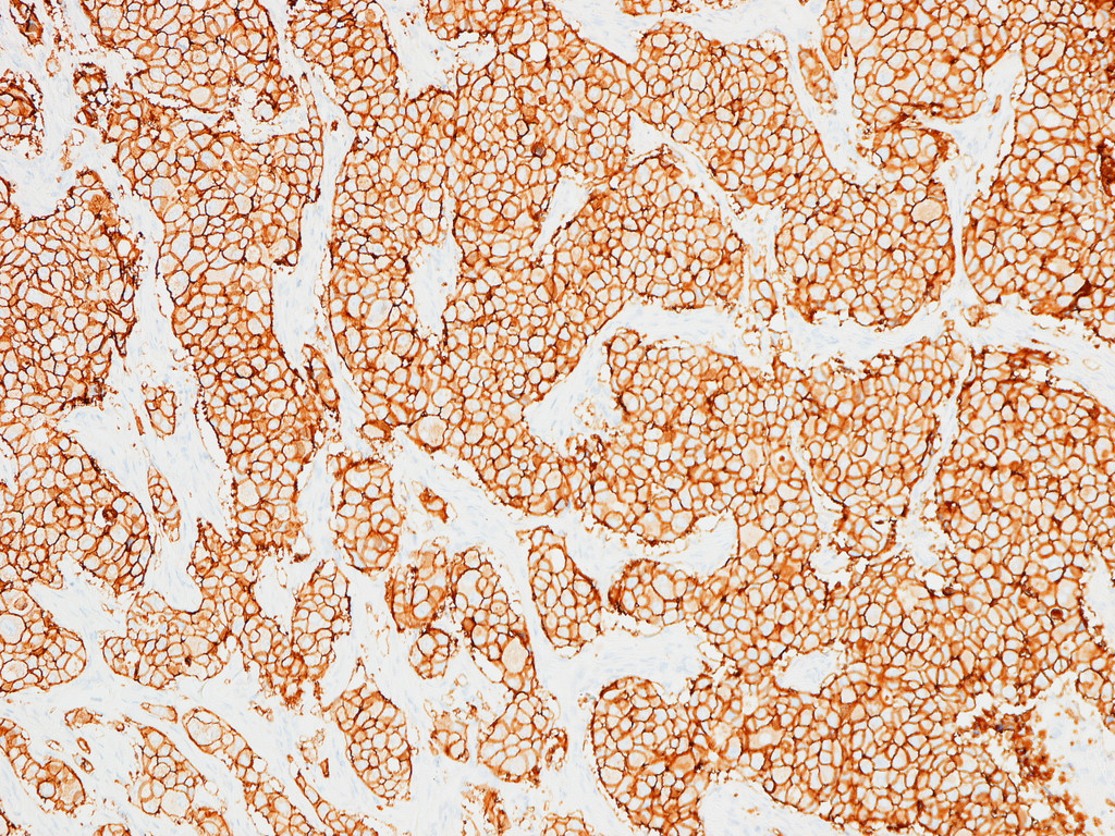 Immunhistochemisches Bild.JPG