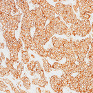 Immunhistochemisches Bild.JPG