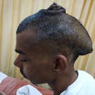 tumor_2.jpg