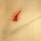 Stent Retriever_Cejna.jpg