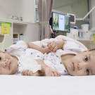 Australia_Conjoined_Twins_15668.jpg
