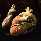 "Körperwelten"-Ausstellung in Wien