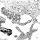 dengue.jpg