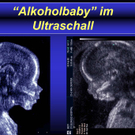 SS und Alkohol-2.jpg