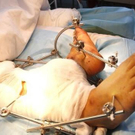Bilder nach der Operation