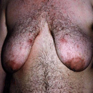 hermaphrodite_neu.jpg