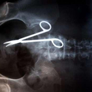 schere-patientin-12014671-mfb-quer_templateId_renderScaled_property_Bild_height_349.jpg