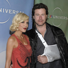 Tori Spelling: Dellen im Dekolleté nach Brust-OP