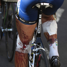 Johnny Hoogerland: Der härteste Profi bei der Tour de France