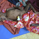 Dürre und schwere Hungersnot in Afrika