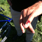 Grüne von Neonazis attackiert