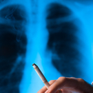 asthma.jpg