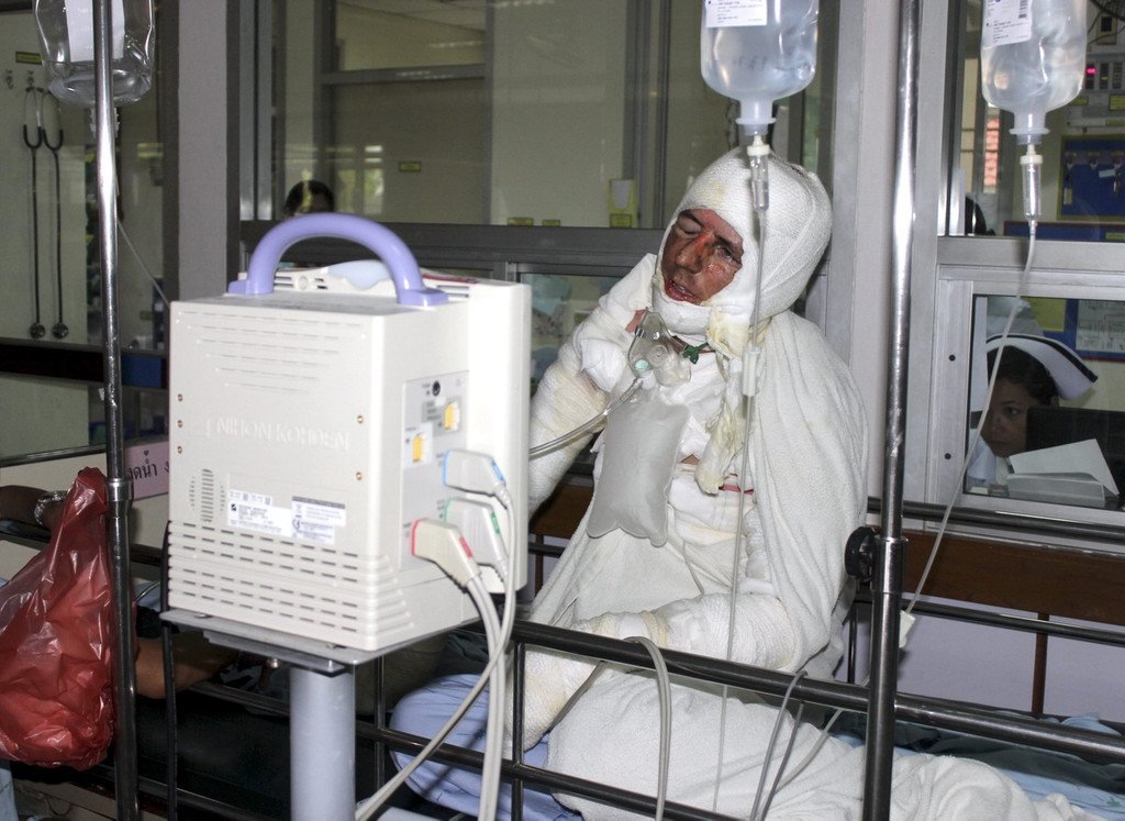 IBD0056-20120817.jpg