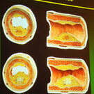 Mehrerau 20-11-2012 19_jpg-1353681829