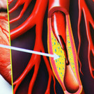 Mehrerau 20-11-2012 23_jpg-1353681877