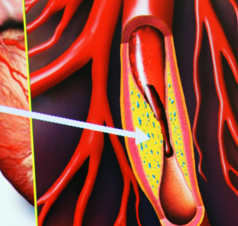 Mehrerau 20-11-2012 23_jpg-1353681877