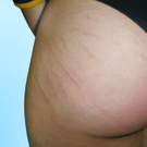 Striae_1.jpg