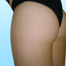 Striae_2.jpg